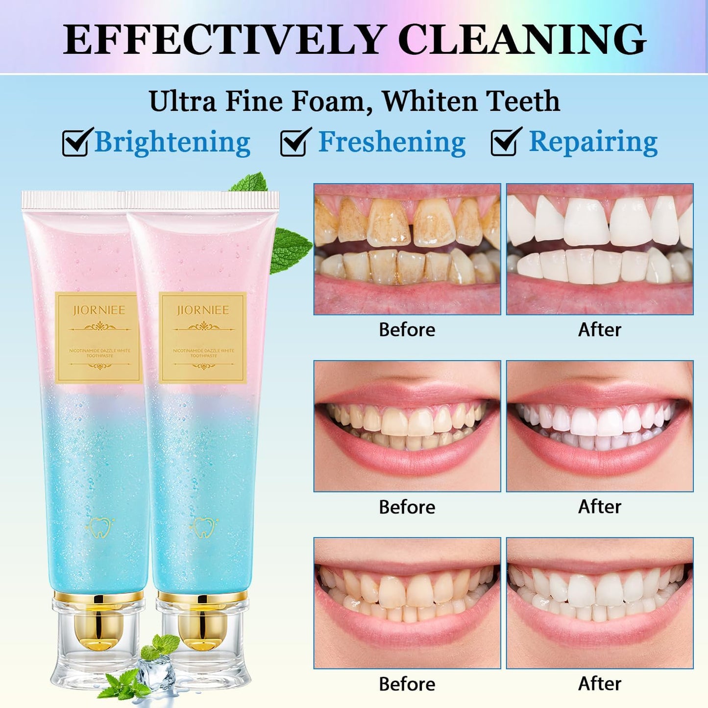 2 PCS Niacinamide Toothpaste, Niacinamide Whitening Toothpaste, Niacinamides Intensive Whitening Toothpastes, Fresh Breath, Remove Tooth Stains